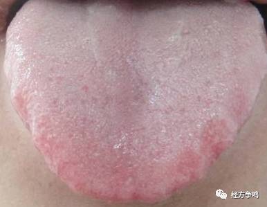 1486817547981790.png 图片